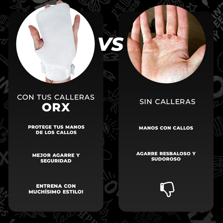Calleras ORX Evolve